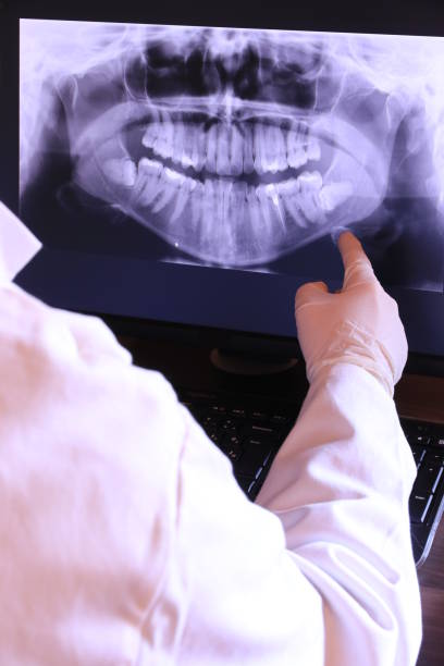 Best Emergency Dental Care for Broken or Chipped Teeth in Prattville, AL